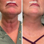 Charger l'image dans la galerie, Botox Antiage Face Serum
