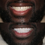 Charger l'image dans la galerie, Dentifrice blanchissant
