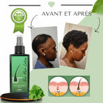 Charger l'image dans la galerie, HAIR NUTRIMENT- FINI LA CALVITIE ( 1 Acheté= 1 Offerte)
