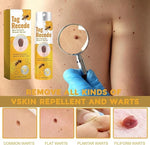 Charger l'image dans la galerie, Spray anti-verrues au venin d'abeille BeeClear™️ (Lot de 2)
