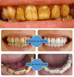 Charger l'image dans la galerie, Dentifrice blanchissant
