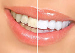 Charger l'image dans la galerie, BloomBright™ Purple Teeth Whitening Gel
