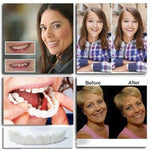 Charger l'image dans la galerie, Ezysmyl™️ Snap-On Dentures
