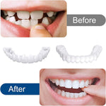 Charger l'image dans la galerie, Ezysmyl™️ Snap-On Dentures
